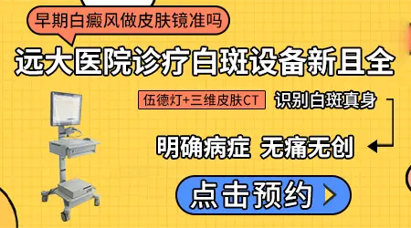 皮肤镜检查白斑能区分白癜风和无色素痣吗