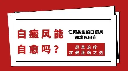 轻度白癜风会自愈吗 白斑不治会怎么样