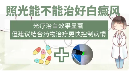 哪种药膏治疗白癜风效果好
