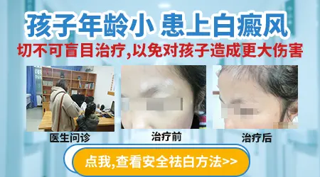 小朋友身上长白色的斑