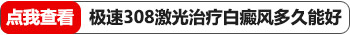 308激光可以照眼部白癜风吗