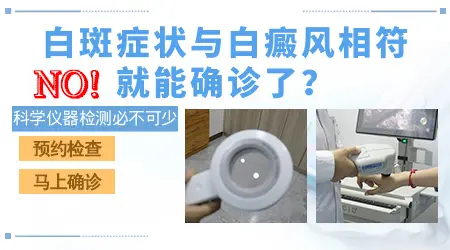 老年性白斑和白癜风的对比图片