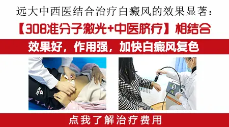 白癜风照光疗一年了还要照吗效果一般