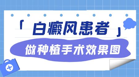 女性白癜风患者做黑色素细胞种植手术承受得住吗