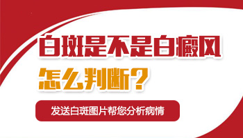 眼角上有一点白如何区别是不是白癜风