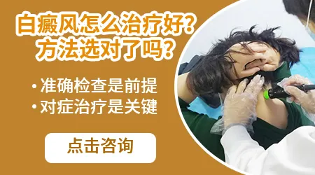 白癜风治疗多久才能控制不扩散