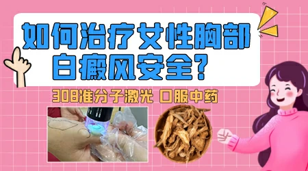 女人乳房白癜风能照光吗