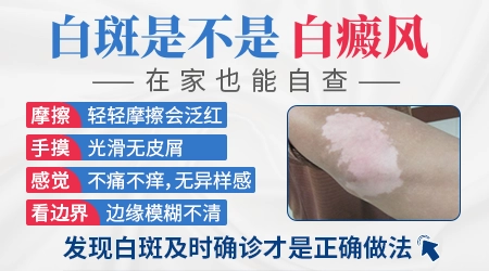 肚子上一块白会不会是白癜风早期