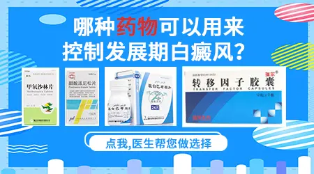 儿童白癜风进展期要怎么控制白斑不扩散