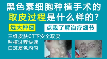 白癜风植皮手术过程图解