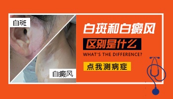 肛门白斑和白癜风的区别