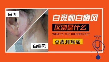 肛门白斑和白癜风的区别