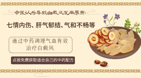 白癜风属于血热吗 为什么会得白癜风