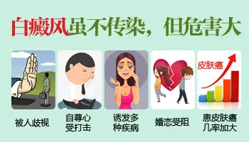 白癜风不治疗会有什么后果