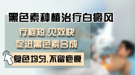 手指白癜风手术能复色吗