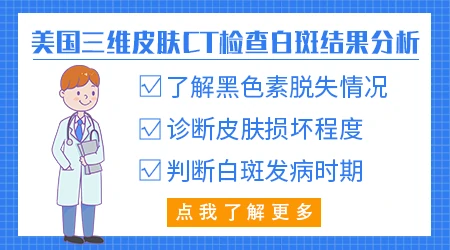 三维皮肤ct可以区分无色素痔和白癜风的区别吗