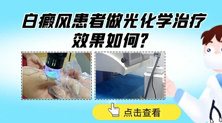 治白斑311和308可以混合用吗