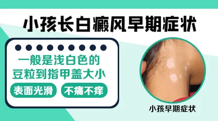 小孩肩上白一片还慢慢变大是什么情况