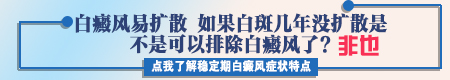 白癜风不治疗会扩散吗 病情加重表现有哪些