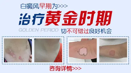 婴儿身上皮肤有一块稍白
