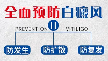白癜风会不会遗传给下一代