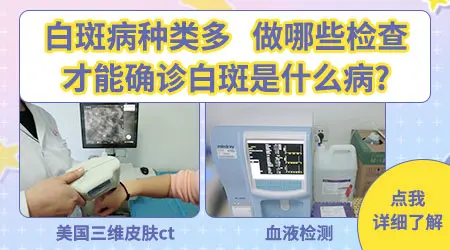 上嘴唇长了块白斑怎么回事