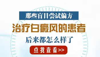 白癜风能使用偏方来治疗吗