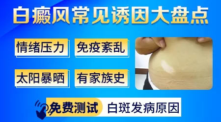 脸上白斑初期得样子
