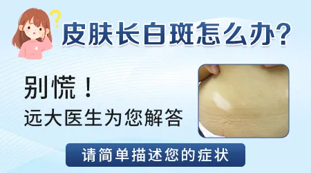 身上长了一片不规则的浅色斑块是什么病
