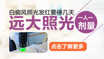 治疗白癜风要用激光刺激到白斑发红吗