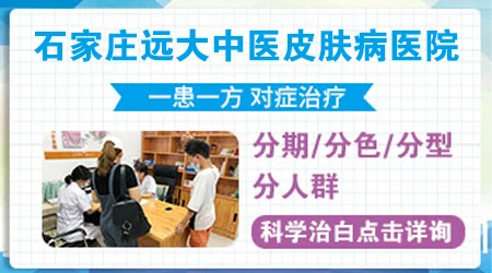 手上皮肤有白斑是什么样子的
