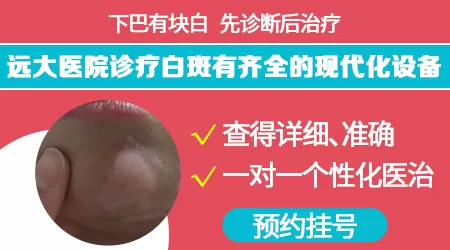 下巴有一块白色的皮肤怎么回事