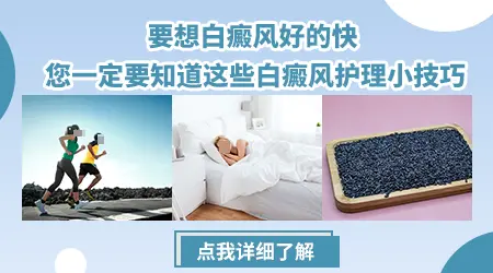 白癜风照射308激光的价格表