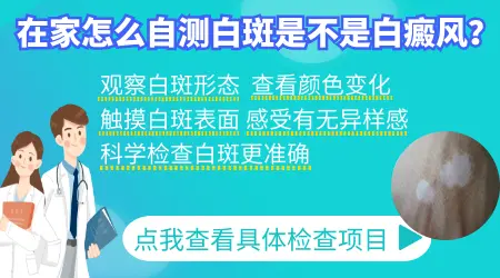 在家怎么判断白斑是不是白癜风