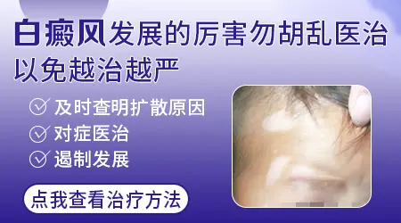 儿童身上有一片白还扩展