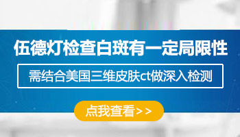 伍德灯下白斑是什么样的才是白癜风