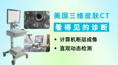 照伍德灯显示淡白色是什么意思