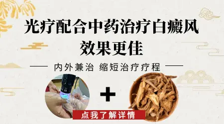 白癜风中药治疗效果好吗