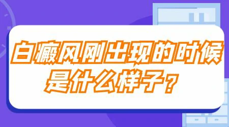 为什么白癜风有的颜色深有的颜色浅