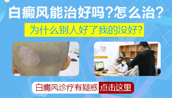 眼睛下面有白癜风能治好吗