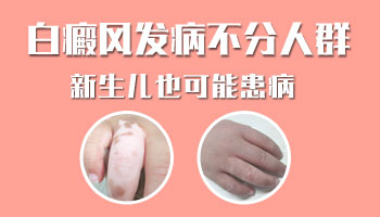 小宝宝外阴周边白斑左腿也有白点了