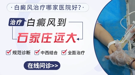 石家庄白癜风哪家医院看得好