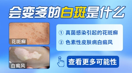 手背上长小白点慢慢变大是怎么回事