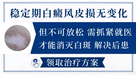 白癜风进入稳定期后还要治疗多久