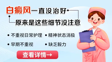 国产308激光能不能治好白癜风