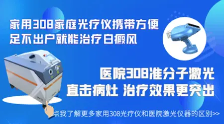 医生会建议购买家用308照白斑吗