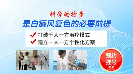 伍德灯检查会不会把白色糠疹误判成白癜风