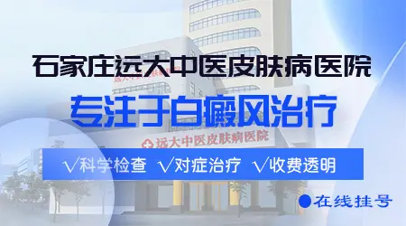 石家庄白癜风治疗专业的皮肤科医院