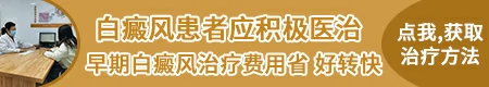 石家庄治疗白斑怎么样 哪家医院308效果好