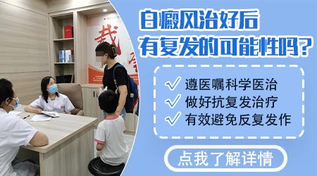 uvb治好白癜风还会复发吗